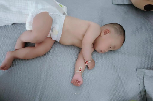 福州六个月宝宝眼睛散光